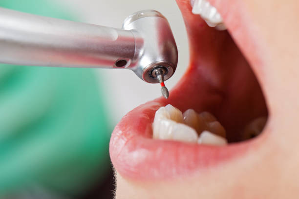 Best Walk-In Emergency Dentist in Riverwoods, IL